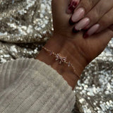 Velix™ Bow Bracelet